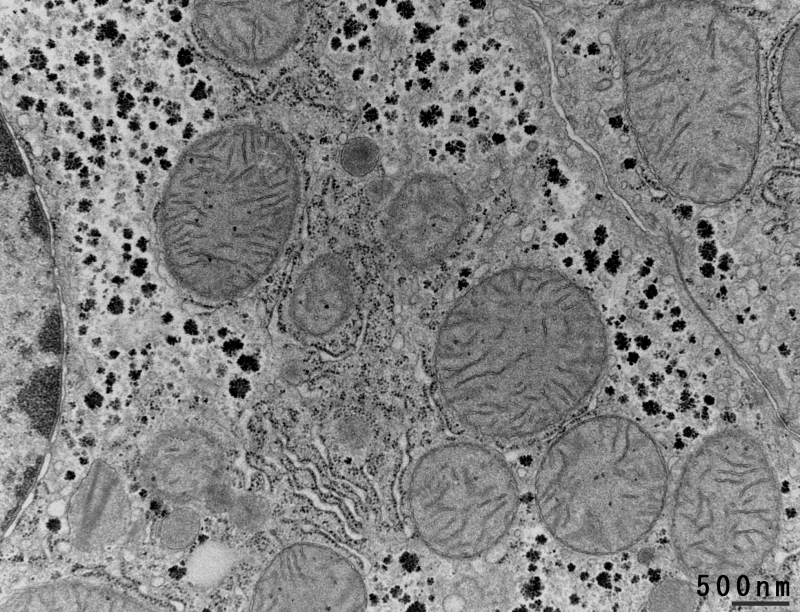 マウス肝臓の電子顕微鏡画像