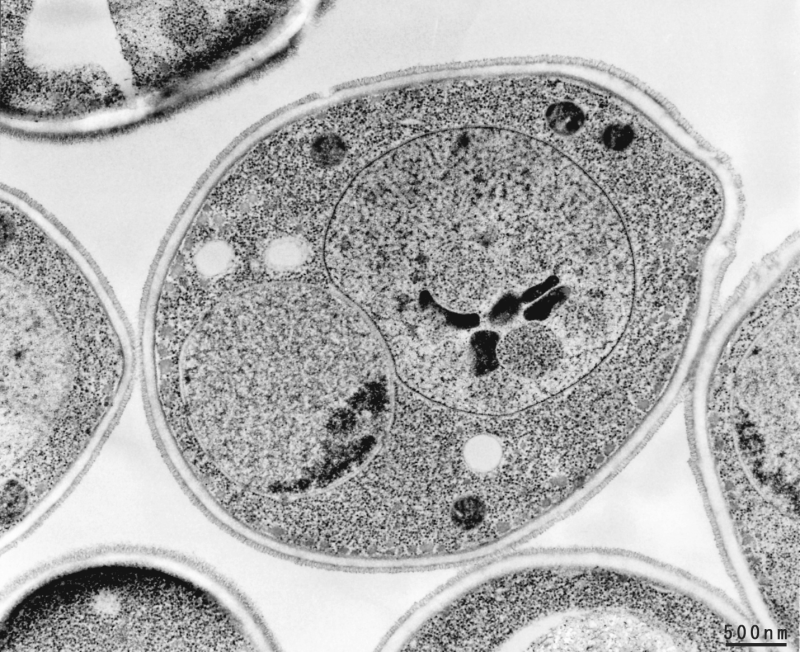 酵母の電子顕微鏡画像