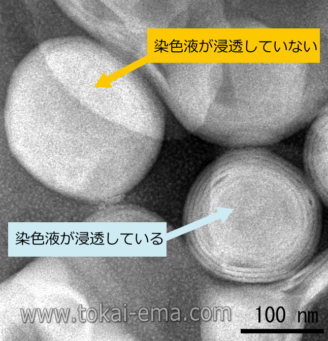 ネガティブ染色法について